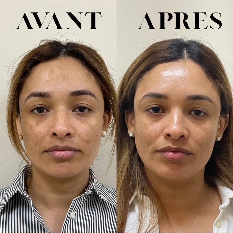 Ice Roller Visage & Corps™ – Effet Fraîcheur Immédiat